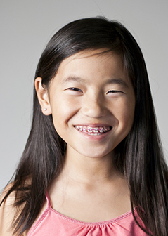 early orthodontic treatment